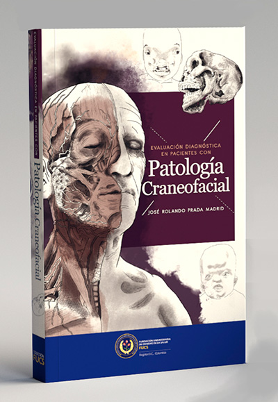 Patología Craneofacial